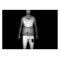 Нанодозовая установка Рельеф