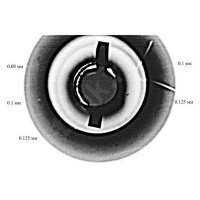 Установка рентгенографического контроля Шило