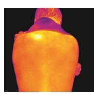 Медицинский тепловизор FLIR PergaMed