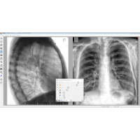 Купить Система рентгеновская диагностическая для преобразования цифровых изображений «ДИАГНОСТ-МЕД» в 